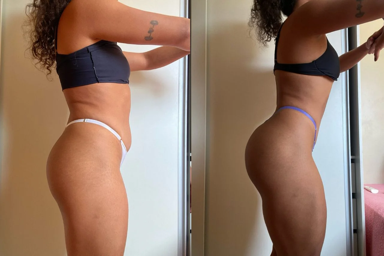 Aluna antes e depois de perfil